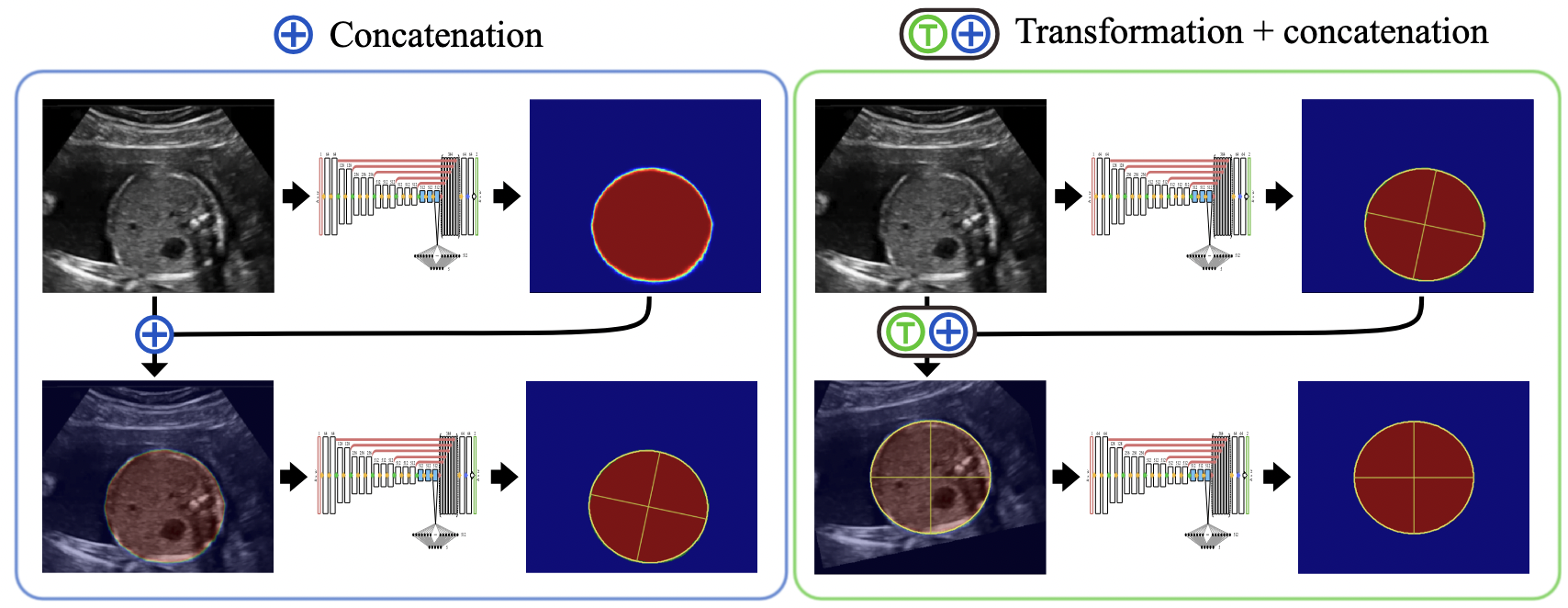 Cascaded transforming multi-task networks for abdominal biometric estimation from ultrasound